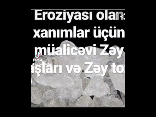 zey dasi eroziyani sagaldir.mikrobu qoxunu qasinmani aparir.0775437871 Aygun x. tebii zey dasi .