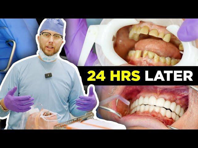 Implants and Bridges: Smile Restoration Looks and Feels Natural Without Bone Removal or Fake Gums