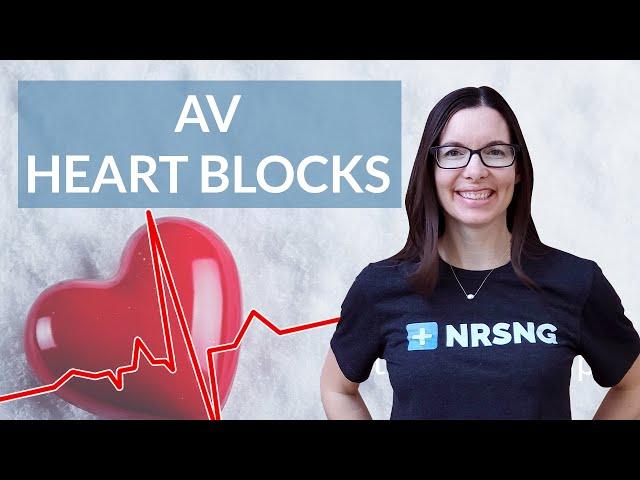 How to interpret AV Heart Blocks on an EKG strip