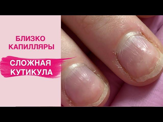 Difficult cuticle | What every manicurist fear