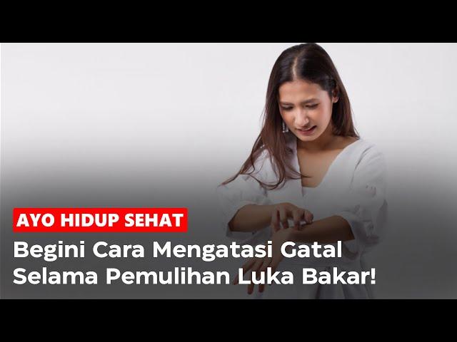 Begini Cara Mengatasi Gatal Selama Pemulihan Luka Bakar! - Ayo Hidup Sehat