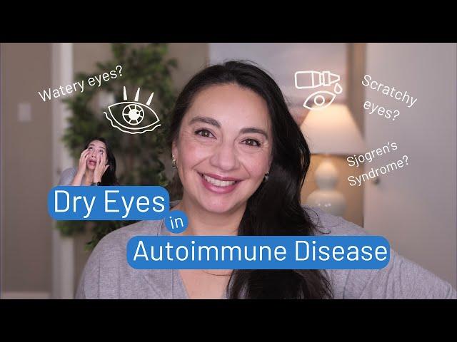 Is it allergies or Lupus? What you need to know about your dry eye and autoimmune condition