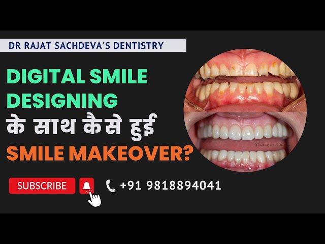 Smile Makeovers by Dr. Rajat Sachdeva |  Dentist In Delhi | Affordable Cosmetic Dentistry