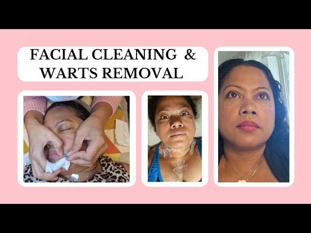 Facial treatment & Warts removal at Meraquel Massage & Relaxation in Gothenburg.