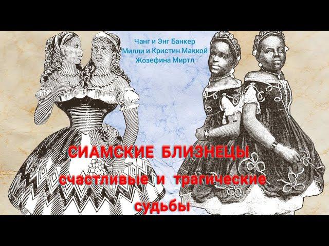 Сиамские близнецы, которые родились и жили в 19 веке. Часть 1.