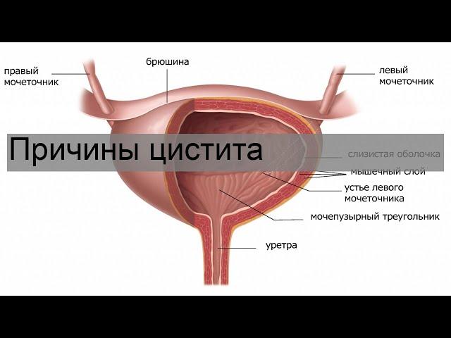 Причины цистита