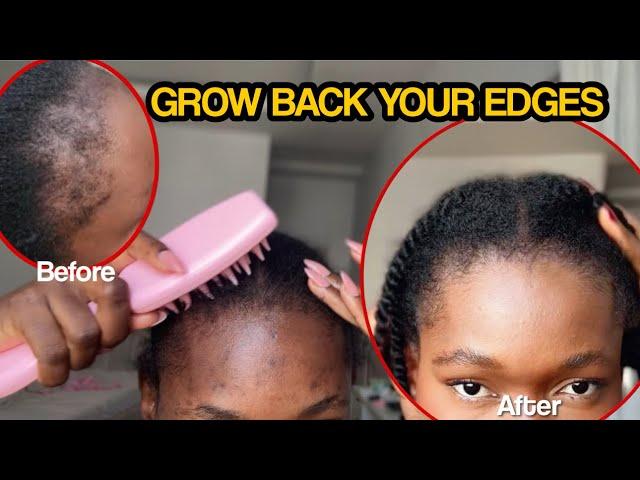 HOW TO GROW BACK EDGES | how to scalp massage for hair growth