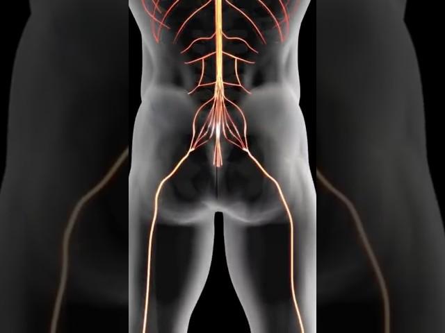 The Cause of Sciatica!