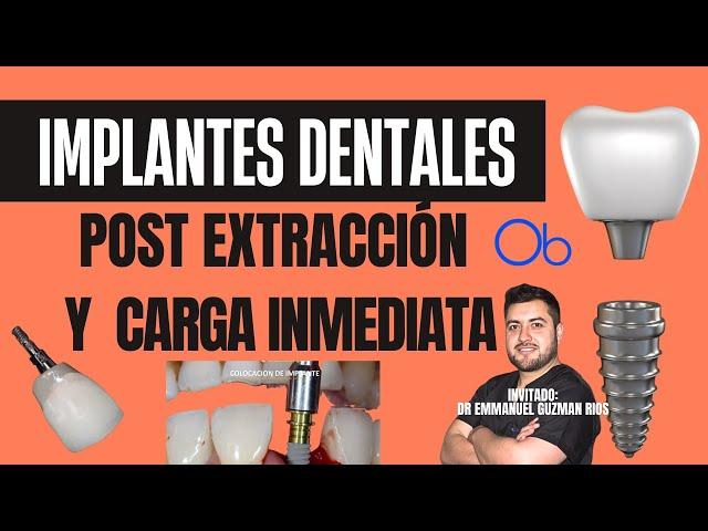 Implantes dentales post extracción y carga inmediata  con Dr Emmanuel Guzmán Ríos