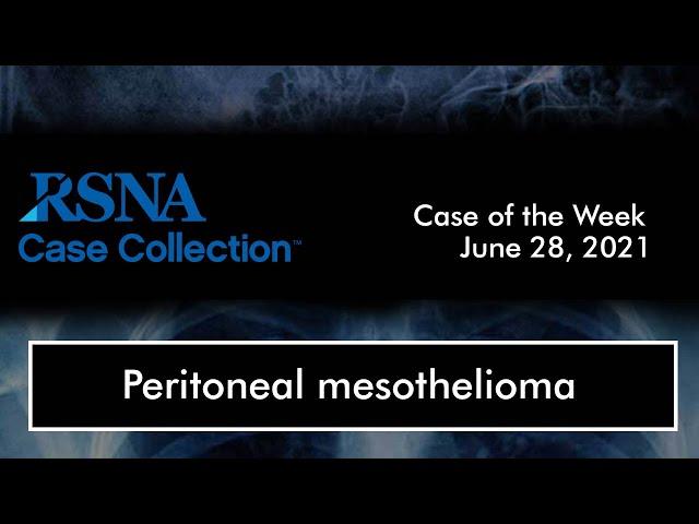 Case of the Week: Peritoneal Mesothelioma