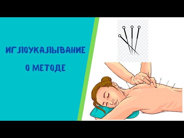 Иглоукалывание,  акупунктура - кратко о методе #Shorts