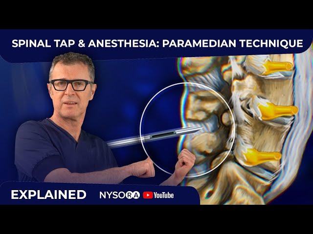 Spinal Tap - Anesthesia: Paramedian Technique - Crash course with Dr. Hadzic