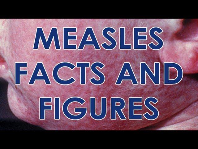 Measles and the MMR Vaccine Facts and Figures