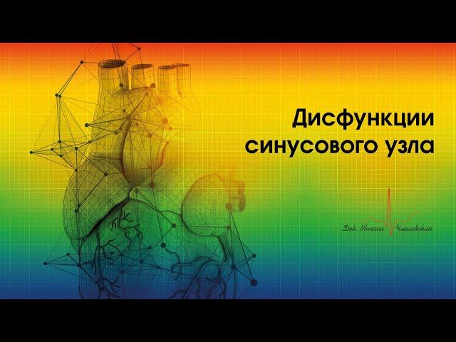 Дисфункции синусового узла