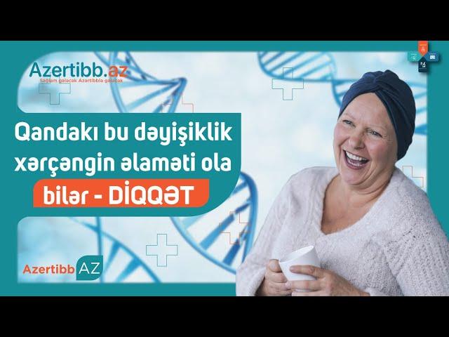 Qandakı bu dəyişiklik xərçəngin əlaməti ola bilər: DİQQƏT