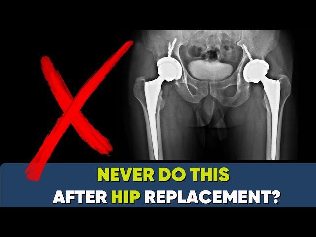 NEVER do this after Hip Replacement!! Myths (गलतफेम्हियाँ) about Hip Replacement?