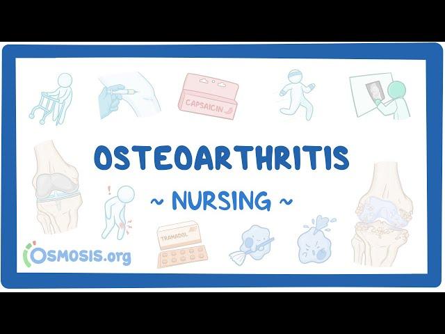 Osteoarthritis: Clinical Nursing Care