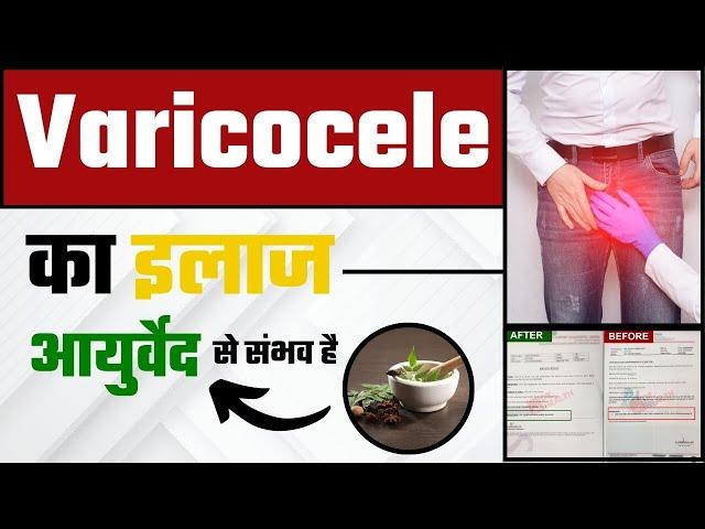 Varicocele का इलाज आयुर्वेद से संभव है | Patient Success Story | Dr. Himanshu Dhawan