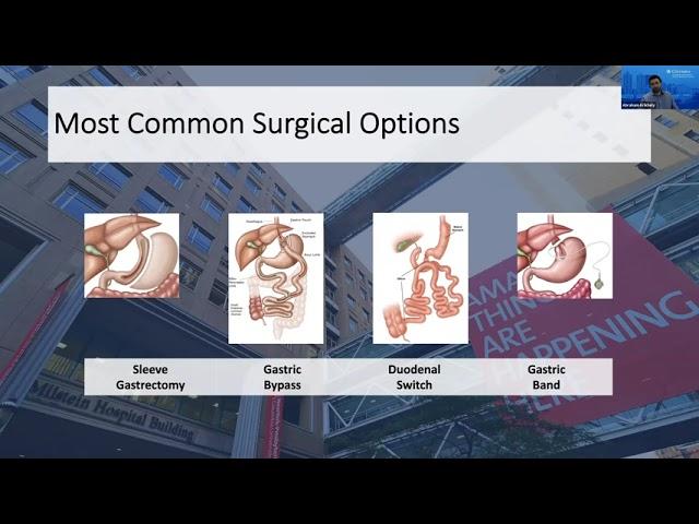 Weight Loss Surgery Q&A: Most Common Surgical Options