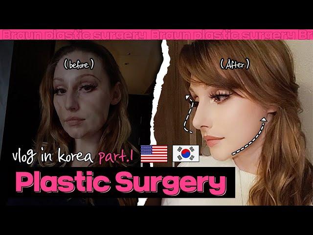 PLASTIC SURGERY IN KOREA (PART 1) I Rhinoplasty, facial contour, facelift