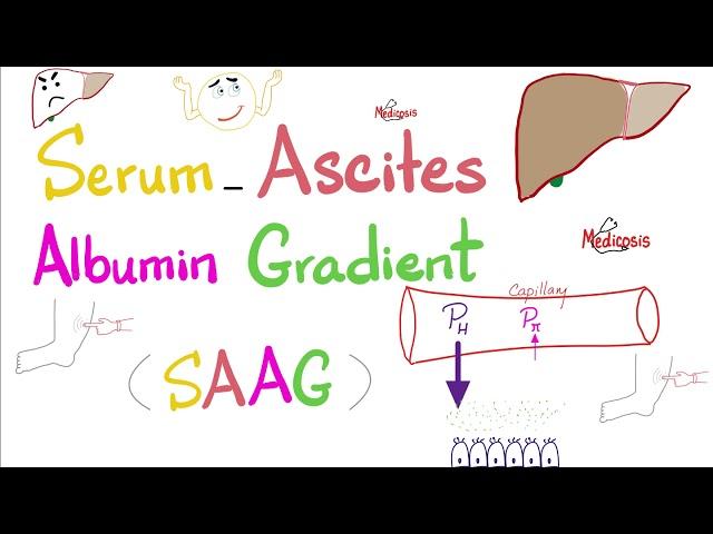 Serum Ascites Albumin Gradient (SAAG) | Peritoneal Effusion | Lab 