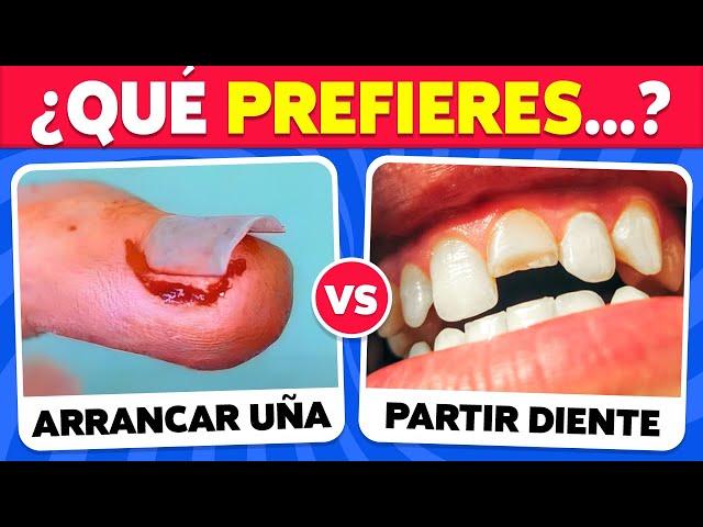  ¿Qué PREFIERES? ¡100 Decisiones EXTREMAS! 