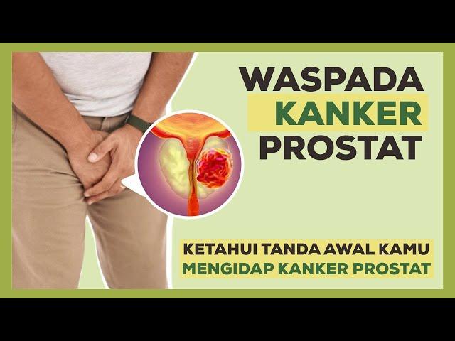 Waspada Kanker Prostat! Tanda-Tanda Ini Bisa Jadi Tidak Kamu Sadari!