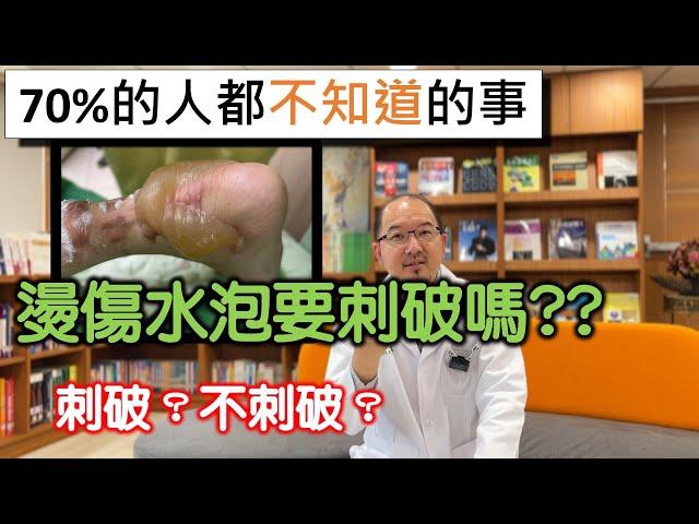 燙傷產生的水泡到底要不要用掉？不用破傷口比較快好？