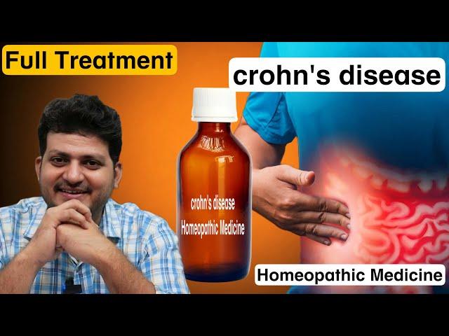 Crohn's Disease | Best Homeopathic Medicine for Crohn's Disease | Homeopathic Combination | Uses