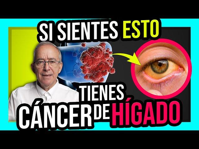 Así Empieza Un CANCER DE HIGADO - Oswaldo Restrepo RSC