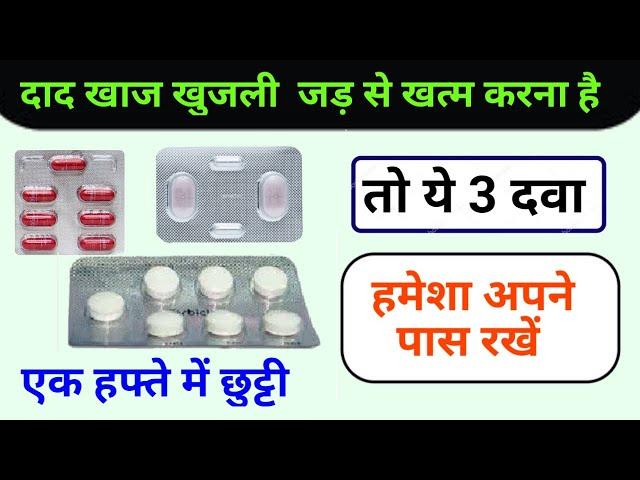 3 Best Medicine Dad Khaj Khujli Problem | जड़ से खत्म करे दाद खाज खुजली को ये 3 मेडिसिन