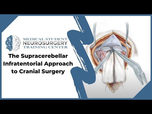 The Supracerebellar Infratentorial Approach to Cranial Surgery