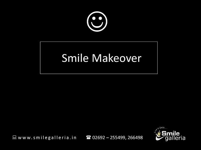 Smile Makeover | Multilayered Zirconia | Aesthetics | Cosmetic Dentistry | Anand - Vallabhvidyanagar