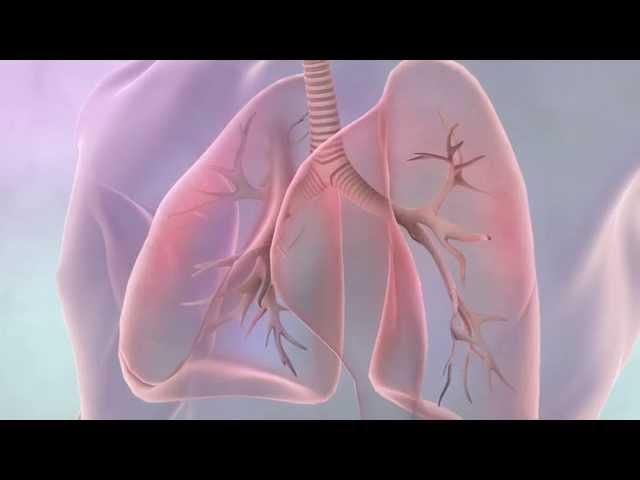 Treatments for lung cancer | Cancer Research UK