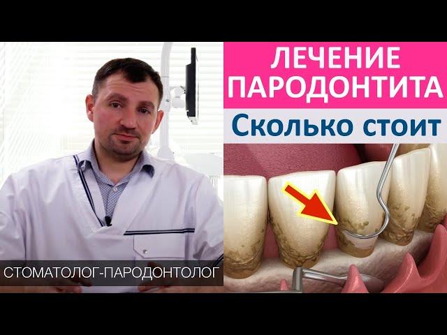 Сколько стоит лечение пародонтита. Признаки пародонтита, степени заболевания, стоимость лечения