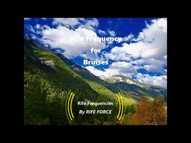 Bruises - Rife Frequency