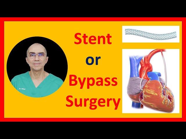 Stent or Bypass Surgery