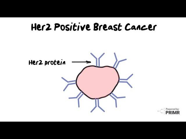 HER2-positive Breast Cancer