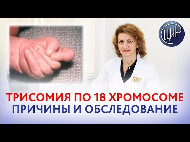 Трисомия по 18 хромосоме: причины,обследование и что делать, чтоб трисомия больше не повторилась.