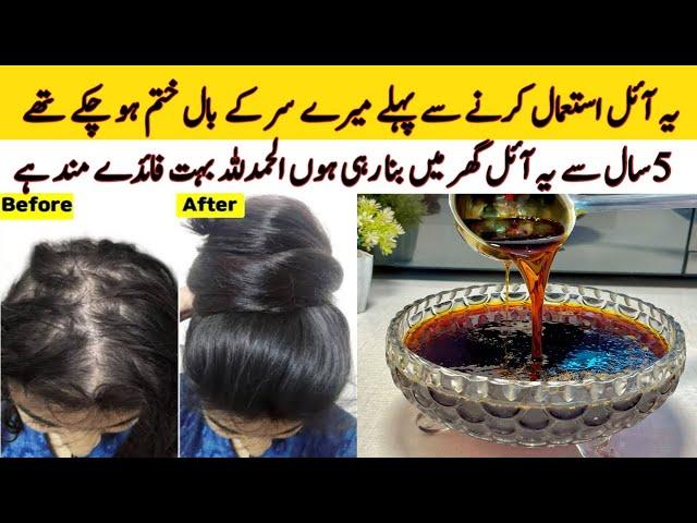 Hair Fall Solution At Home | Onion Hair Oil Remedy For Hair Growth