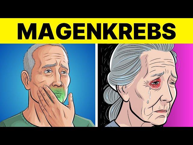 8 Seltsame Anzeichen von MAGENKREBS (Symptome von Magenkrebs)