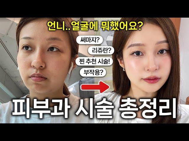 피부과 시술 & 얼굴 관리 총정리 돈 절대 안 아까운! 추천 vs 비추천? 홈케어 꿀템? 망한 부작용썰...