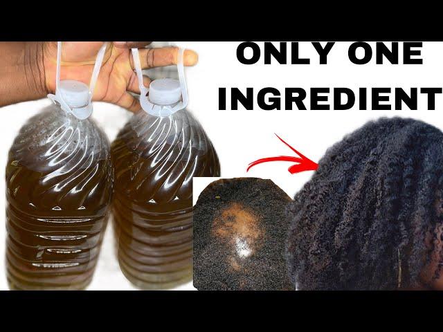 HAIR GROWTH TONIC; a million times BETTER THAN CLOVES WATER! HOW I GREW MY HAIR FASTER