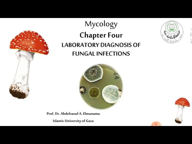 Laboratory diagnosis of fungal infections