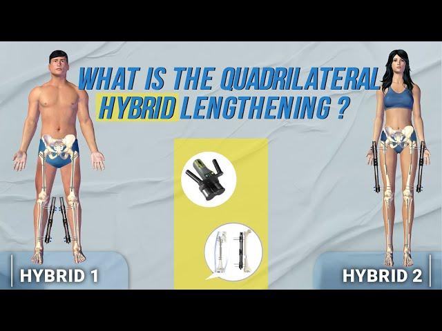 WHAT IS THE QUADRILATERAL HYBRID LENGTHENING?