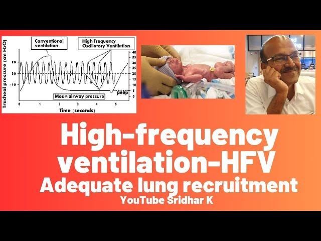 High frequency ventilation l Adequate lung recruitment on HFV