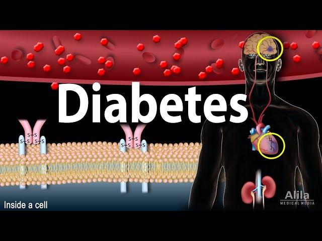 Diabetes mellitus - Symptoms, Complication, Pathology of Type 1 and Type 2, Animation