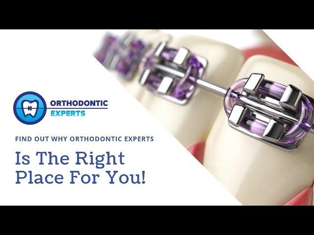 WHY YOU HAVE TO CHECK OUT ORTHODONTIC EXPERTS!!! | Orthodontist Chicago, IL