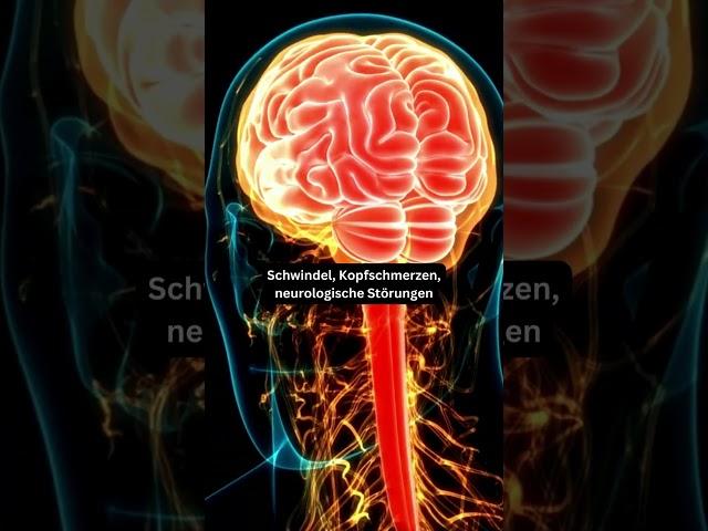 Brain Facts #brain #Umweltgift #gehirngesundheit