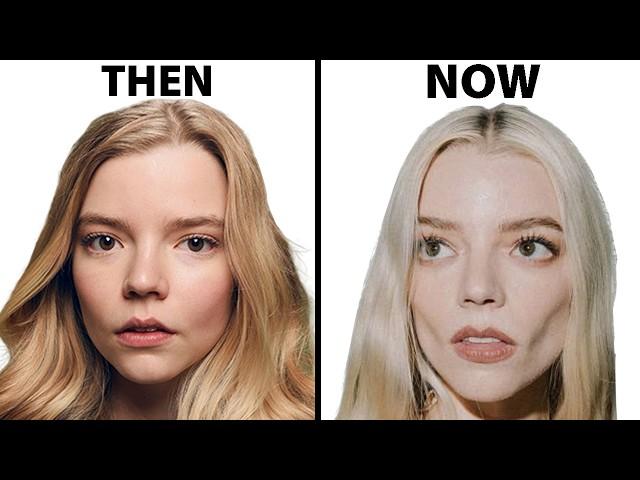 Anya Taylor-Joy's NEW FACE | Plastic Surgery Analysis